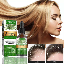 Rosemary Hair Growth Serum anti Hair Loss Products Fast Regrowth Essential Oil Repair Scalp Frizzy Thinning Damaged Hair Care