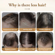 Hair Growth Spray Hair Loss Treatment Oil for Men Women Ginger Fast Hair Regrowth Thinning Hair Care Products